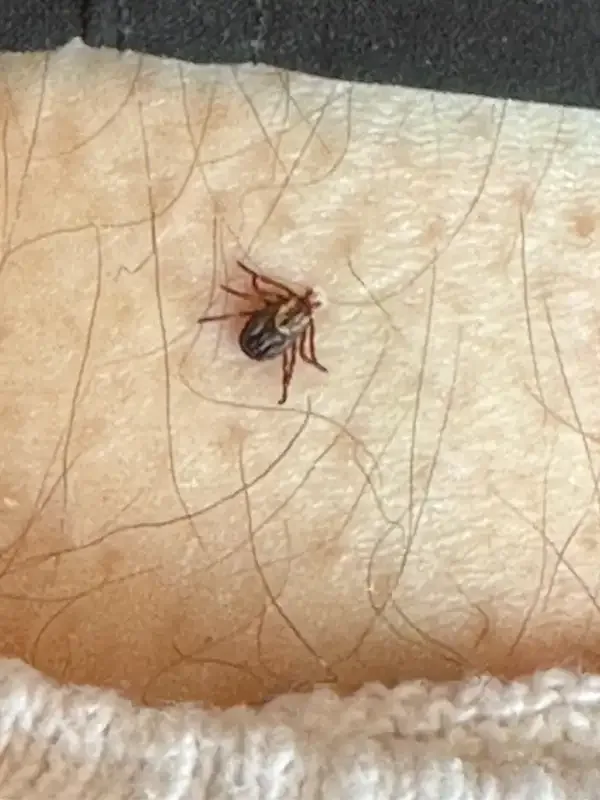 COCKROACH, BEDBUG, MICE, ANTS, WASP - PEST CONTROL in Other in London - Image 11